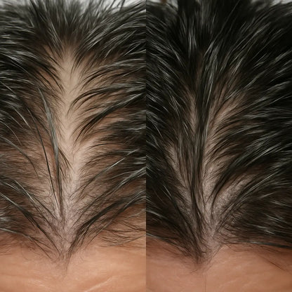 Intense Hair Growth Kit
